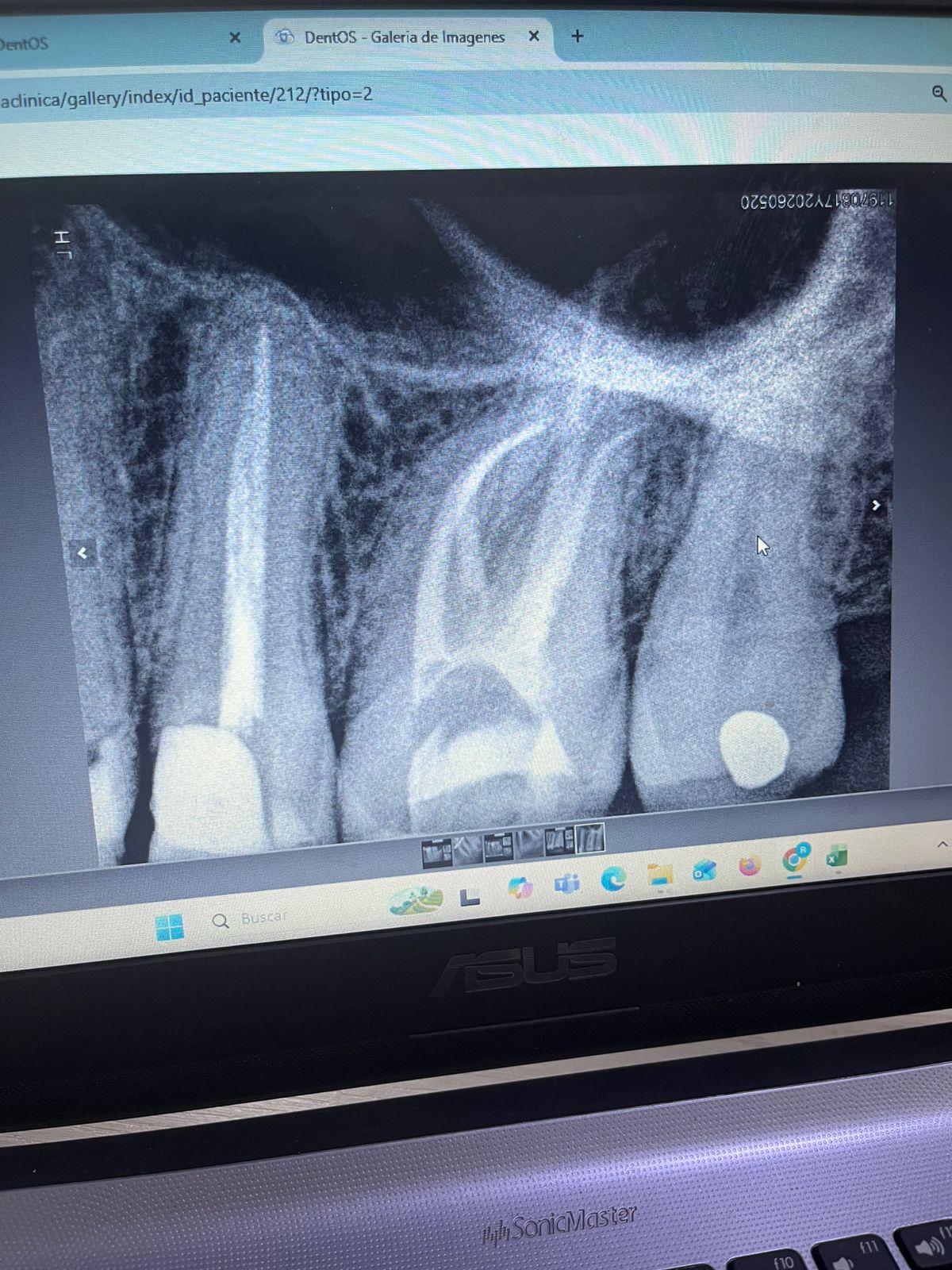 Endodoncia sin dolor Lux Dent Boyacá